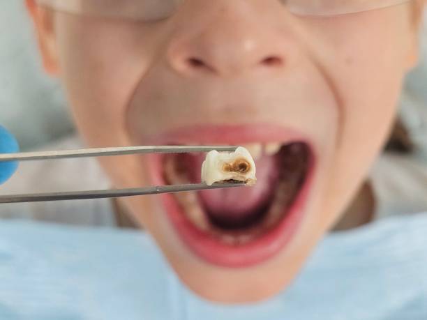 Best Emergency Pediatric Dental Care in Grinnell, IA